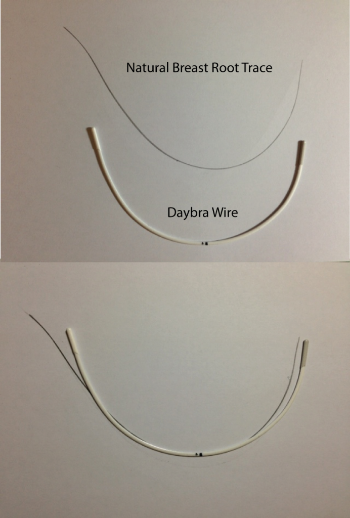 Breast Root Trace